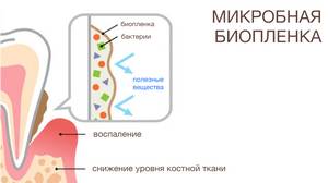 Биопленку образуют погруженные во внеклеточный матрикс и прикрепленные к поверхности зубов колонии микроорганизмов