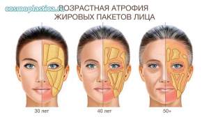 С возрастом жировые пакеты лица истончаются