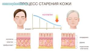 Какие изменения происходят внутри увядающей кожи