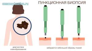 Гистология &ndash; это анализ взятых (как правило, в процессе биопсии) у пациента тканей под микроскопом