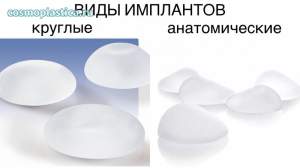 Производители предлагают пациентам две основные формы имплантов - круглую и анатомическую