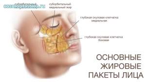 Как расположены основные жировые пакеты лица у мужчин